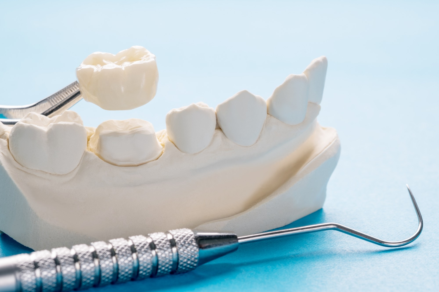 Fixed Crowns & Bridges